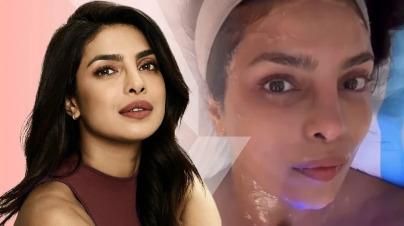 Rahasia Kulit Kencang Priyanka Chopra: XERF Bikin Awet Muda Tanpa Operasi